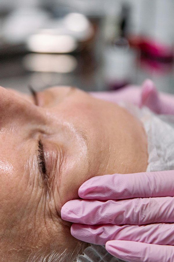 Discover effective wrinkle reduction treatments for youthful skin